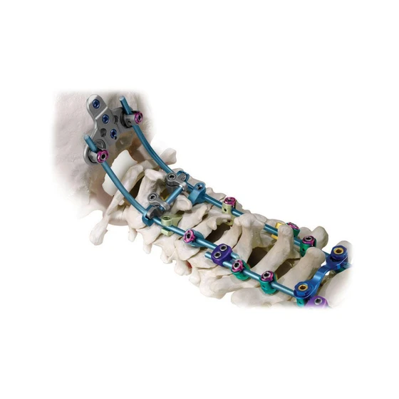 spine-surgery-implants-1.webp