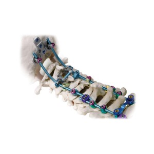 Spine Surgery Implants